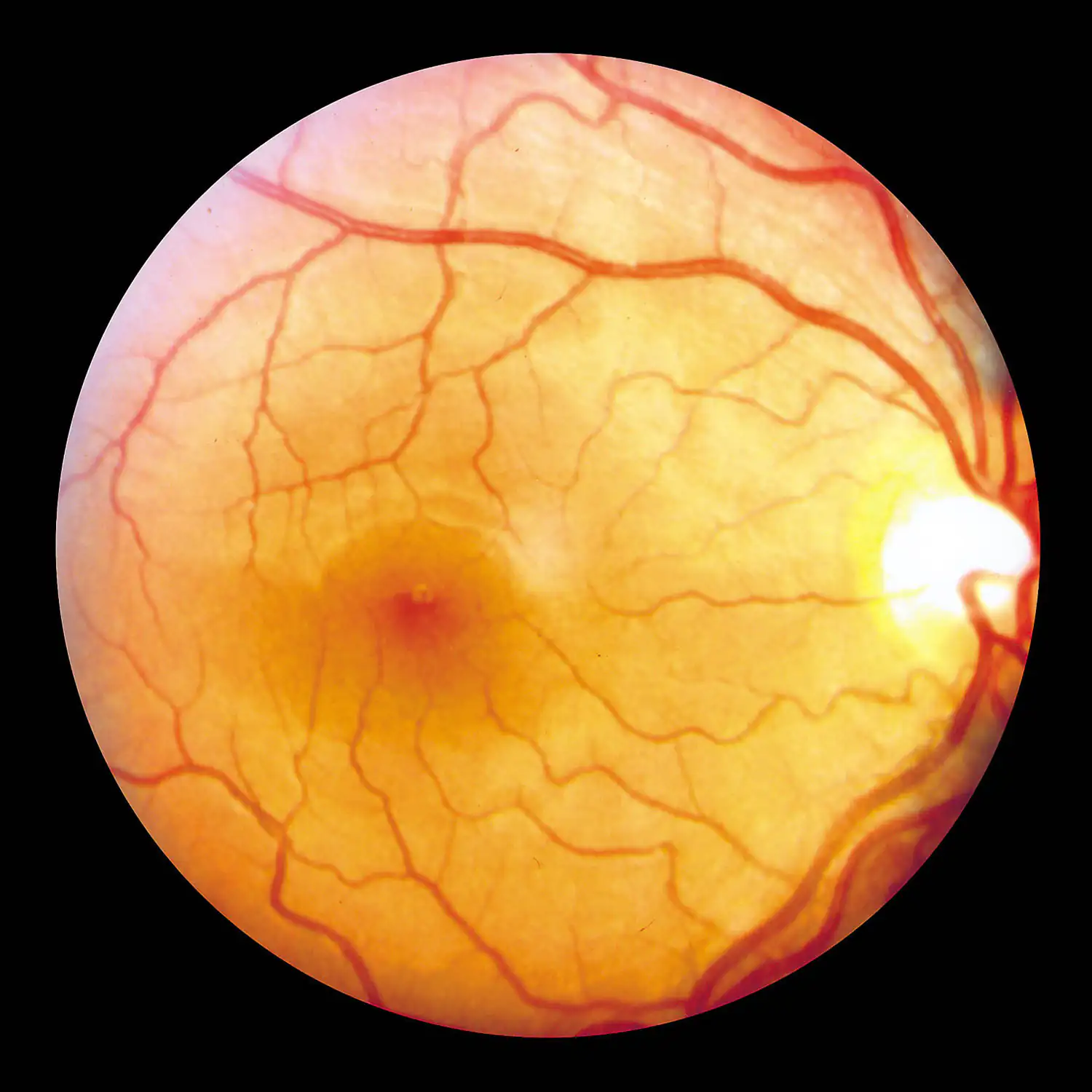 retina of the eye
